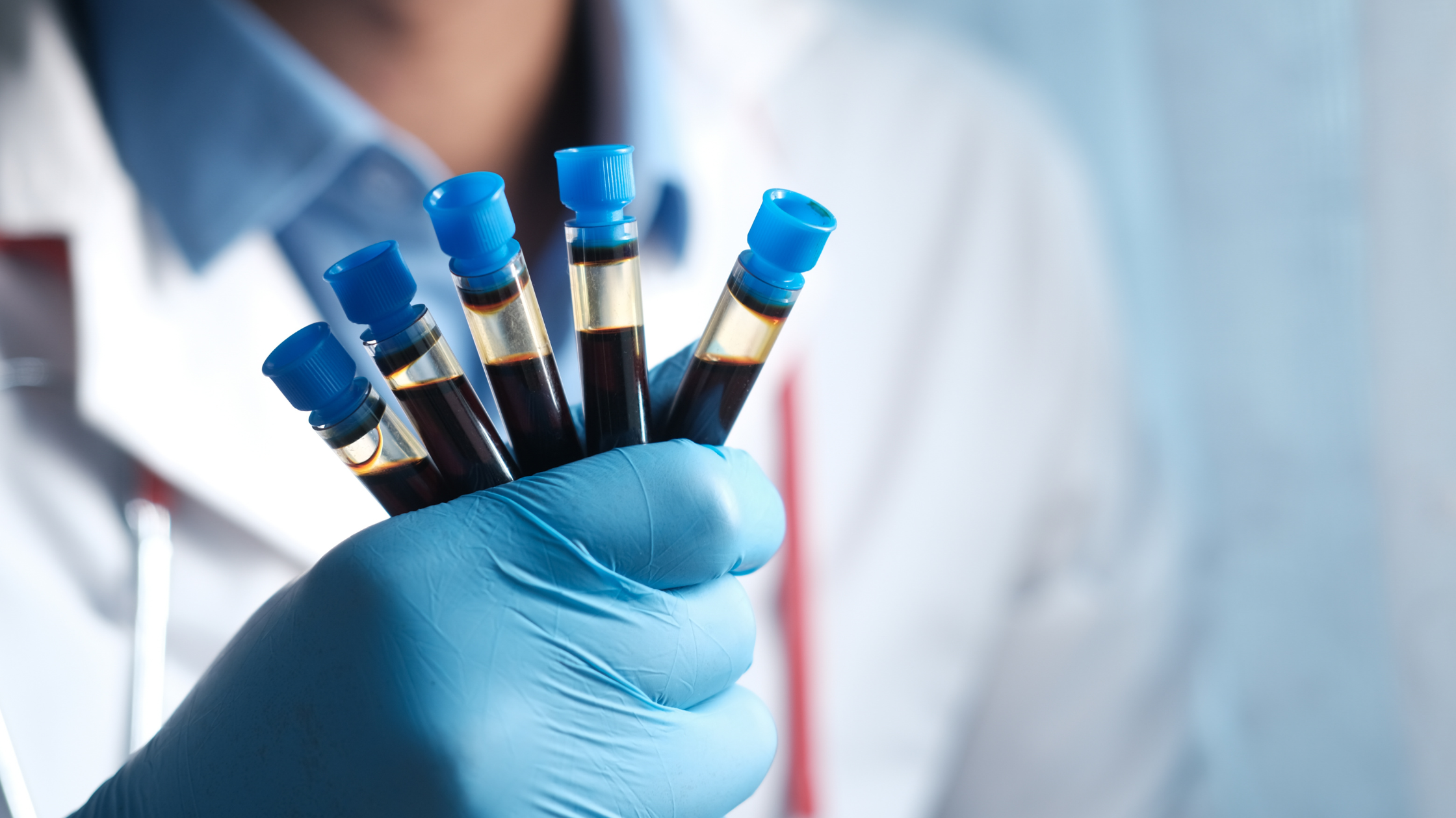 hematologija kragujevac - poliklnika dr mijatovic