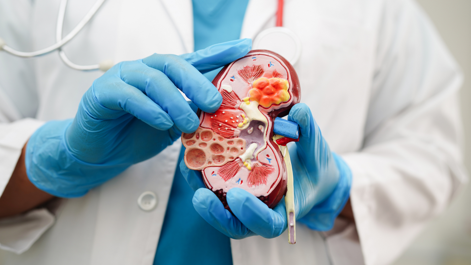 urologija kragujevac - poliklinika dr mijatovic